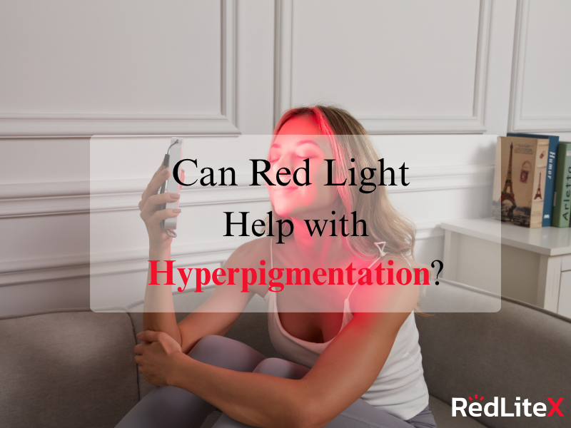 Can Red Light Help with Hyperpigmentation