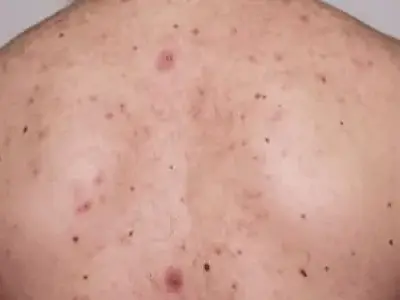 Day 1