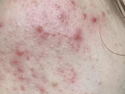 Day 1