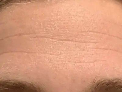 Day 1