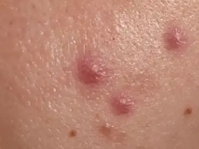 Day 1